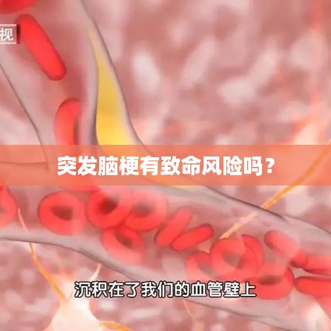 突發(fā)腦梗有致命風(fēng)險(xiǎn)嗎？