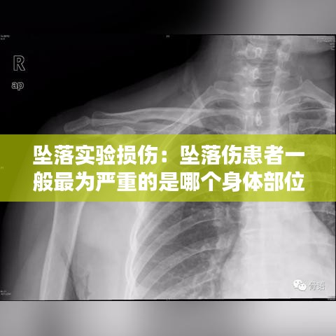 墜落實(shí)驗(yàn)損傷：墜落傷患者一般最為嚴(yán)重的是哪個身體部位 