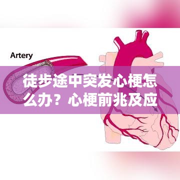 徒步途中突發(fā)心梗怎么辦？心梗前兆及應(yīng)對措施科普！
