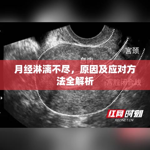 月經(jīng)淋漓不盡，原因及應(yīng)對(duì)方法全解析