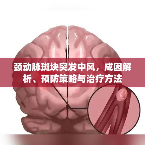 頸動(dòng)脈斑塊突發(fā)中風(fēng)，成因解析、預(yù)防策略與治療方法